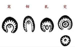 窝钳乳突四种穴形